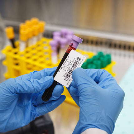 76 mm Core Polypropylene Autoclave and Liquid Nitrogen Labels with Vial Top